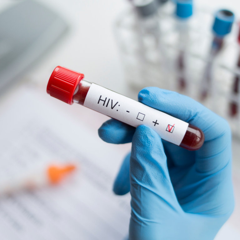 the-ripple-effect-how-early-hiv-detection-benefits-entire-communities